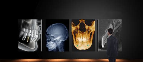 Oral And Maxillofacial Radiology Dental Imaging Services .